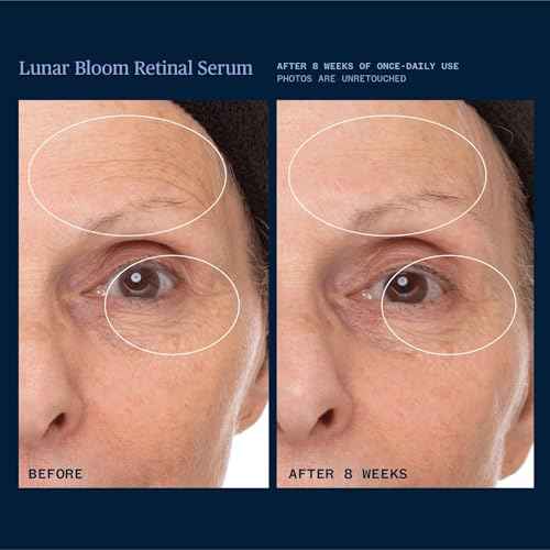 Ursa Major Lunar Bloom Retinal Serum | Potent & Gentle Facial Moisturizer | Smooth Fine Lines & Wrinkles | Vegan & Cruelty-Free | For All Skin Types | 1.0 ounce