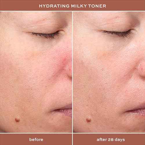 ITK Hydrating Hyaluronic Acid Milky Face Toner for Dry Skin + Redness with Green Tea + Squalane - Prep, Tone + Calm Skin for Women - Soothing Vegan Moisturizing Facial Toner - 5 oz.