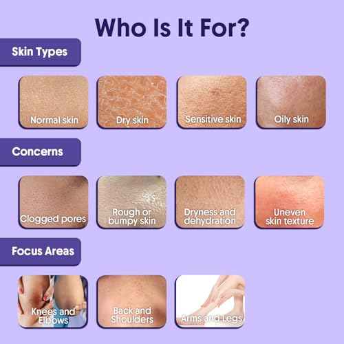 Aravi Organic 10% AHA + 1% BHA Exfoliating Body Lotion - Glycolic & Lactic Acid Body Lotion with Niacinamide - Smooths Rough & Bumpy Skin with Anti-Aging - 6.76 Fl Oz / 200ml