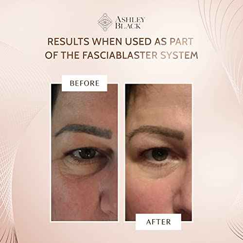 The Bunny Blaster FasciaBlaster by Ashley Black. Our Fan Favorite Tool for Smoothing Lip Lines. Use around the eyes for Brow Lift and dark circles. Sculpt Jawline and Nose.