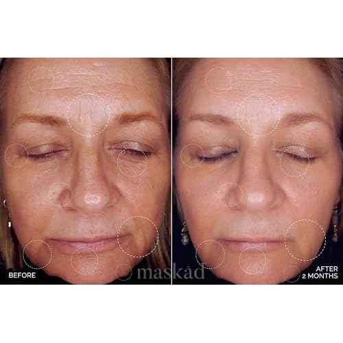 MASK?D¢ç Advanced Anti-Aging Multi-Peptide Enriched Facial Serum, Peptide Serum to Support Skin Appearance, Fine Lines, & Hydration, Collagen-Focused Care, Clean, Gentle Skin Care, Extra Large 2oz