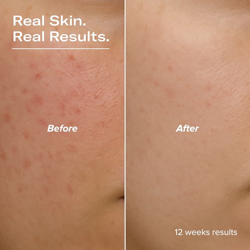 BRIGHTEN 15% Stabilized Vitamin C Serum with Glutathione, Ferulic Acid, Hexylresorcinol, Kakadu Plum, Vitamin E, Brightening, Glowing Skin, Anti-Aging 1 fl oz