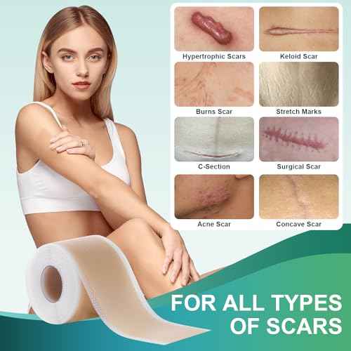 Medical Grade Silicone Scar Sheets, Silicone Scar Tape (1.6¡±x 60¡± Roll-1.5M), Professional Scar Removal Treatment, Reusable Silicone Scar Strip for Keloid, C-Section, Surgery, Burns, Acne Etc