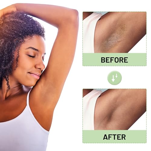 Skin Bleaching Cream for Intimate Areas & Body, Vitamin C Whitening for Underarms, Knees, Elbows, Inner Thighs, Bikini Line ? Sensitive Skin Whitening Lightening Cream for Women