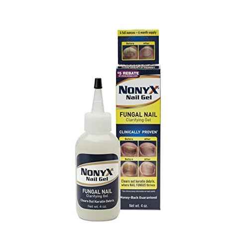 Nonyx Nail Gel, 4.0 OZ (2 Pack)