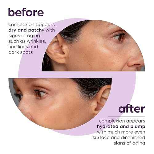 50% Beta Glucan Anti-Aging, Plumping Serum