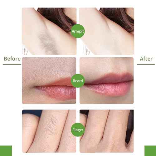 Facial Wax Strips for Women ? 98% Natural Formula, Hypoallergenic for Sensitive Skin ? Face Wax Strip for Hair Removal, Gentle & Quick Eyebrow Wax Strips for Upper Lip, Chin, Legs & Bikini Line