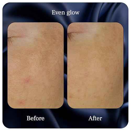 Even Glow - Organic Vitamin C Serum for Dark Spots on Face - Dark Spot Corrector, Dark Spot Remover for Face & Body - with Kakadu Plum Extract, Maple Leaf Extract, Aloe Leaf Juice & More - 1 Fl Oz