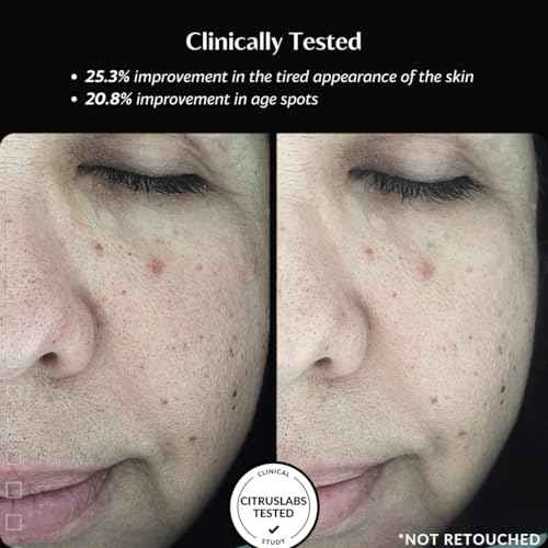 Thursty Skin Hydrating Fluid | Anti-Aging Face Serum with 5 Types of Hyaluronic Acid & Rambutan | Deep Hydration Targets Collagen Skin Renewal Firming & Radiance ? Clinically Tested ? 30ml