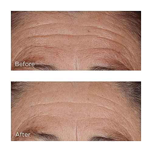 Perricone MD High Potency Hyaluronic Intensive Hydrating Serum, 2 fl. oz.