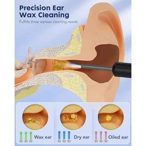 Ear Wax Removal,Littlelucky- 4 in 1 Ear Canal Cleaner 1080P HD Lens with 6 LED Lights for Ear/Nose/Throat/Skin Viewing,Ear Cleaning Kit with 6 Piece Ear Set & 9 Replacement Tips for iOS & Android