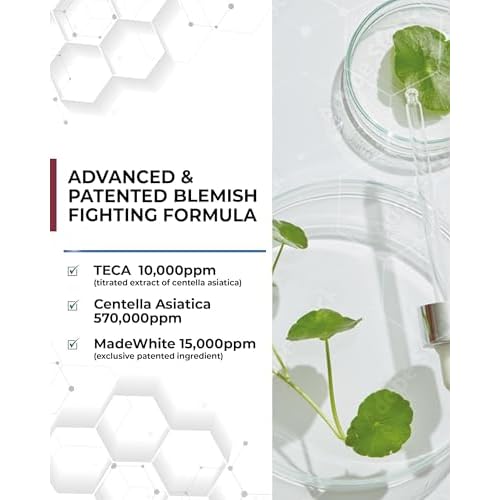 Centellian 24 Expert Ampoule (Season 2, 0.2fl oz x 4 pcs) - Korean Serum for Face. Soothing, Even Tone, Dry Sensitive Skin. TECA, Centella Asiatica, Gotu Kola