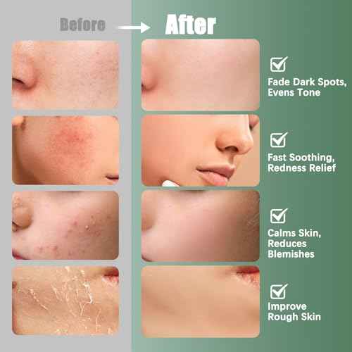 Madecassoside Toner Pads|Soothe Redness,Strengthen Barrier & Refine Pores with Centella Asiatica,Caffeine + Niacinamide | 110 Pads for All Skin Types