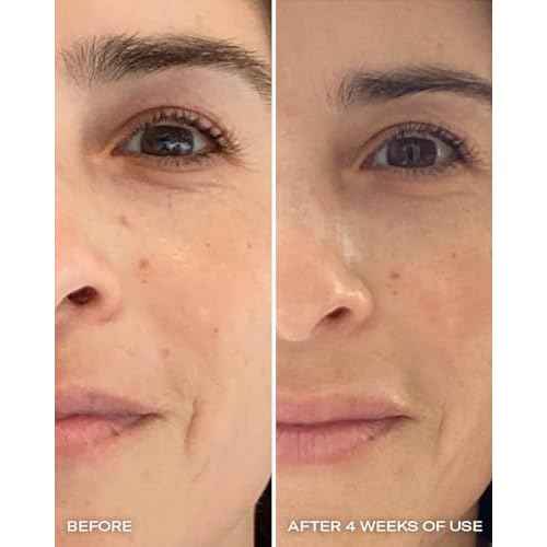 Then I Met You Ros? Resurfacing Facial Mask, Nourishing & Brightening Face Treatment with AHA, BHA & Resveratrol, Vegan & Clean Skincare, 1.76 oz