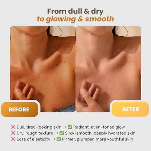 CLARIMOND Vitamin C Body Cream | Hyaluronic Acid & Collagen for Women | Hydrating Body Care Cream for Dry, Aging Skin | Fast-Absorbing, Non-Greasy Formula | Paraben & Sulfate Free | 200ml