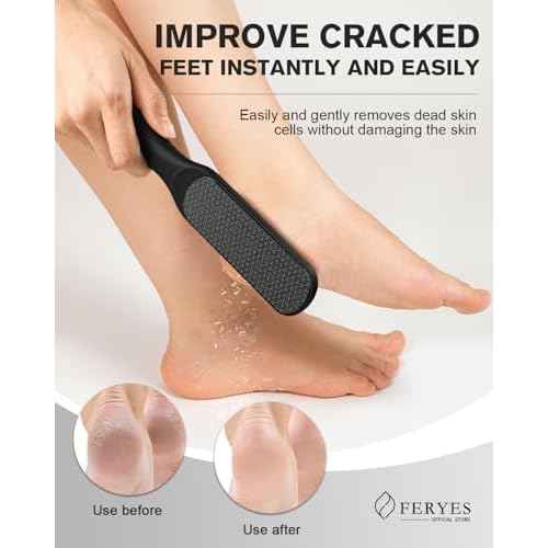 FERYES Dual-Sided Glass Foot File ? Long Handle Foot Scrubber for Dead Skin, Cracked Heel Repair, Pedicure Tools for Callus Removal, Glass Pumice Stone Foot Scraper - Black