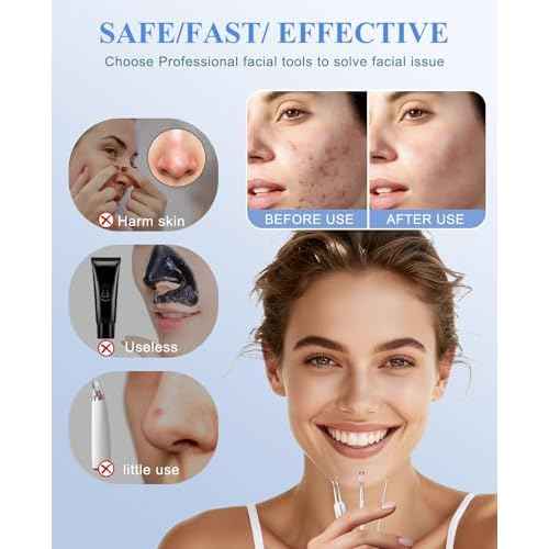 3PCS Pimple Extractor Acne Treatment Tool Professional Stainless Blackhead Comedone Removal Popper Tool for Face Nose Blackhead Extractor Tool (Silver)