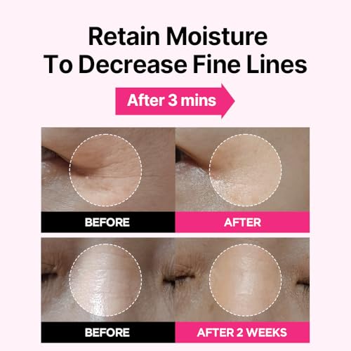 ISOI Blemish Care Up Facial Serum Triple Set, Korean Skin Care Set for Glass Skin Radiance, 2 Full Size & 1 Refill, Eye & Wrinkle Patch Tester, Daily Hydration Skincare Gift for Women (2.13 fl. oz)