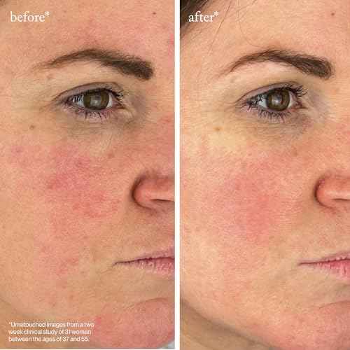 goop Beauty Peptide Serum | Reduces Fine Lines, Wrinkles, & Dark Spots | Peptides, Ceramides, & Niacinamide | Anti Aging Treatment to Improve Firmness & Elasticity | 1 fl oz