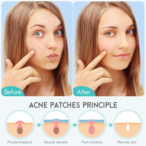 Acne Pimple and blackheads Remover Hydrocolloid patches, 350pcs Holiday colour Star and UltraThin Clear Stickers for Zits, Pimples, Acne,with Salicylic Acid, Tea Tree Oil, Centella acne stick set