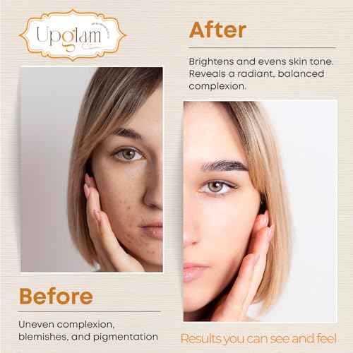 Kojic Acid Lightening Soap - Premium Dark Spot Remover for Face & Body - Infused with Tumeric, Lemon & Vitamin E - Gentle Natural Cleanser with Coconut Oil for Radiant, Even Skin (2 Pack)