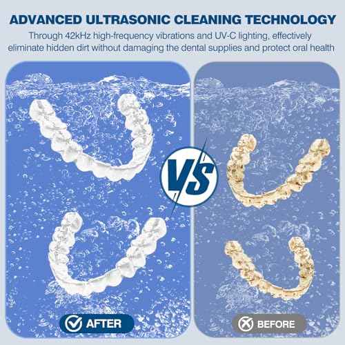 Dental Ultrasonic Retainer Cleaner Machine: 42KHz 28W 180ml,Dental Cleaning Pod for Dentures, Aligners & Mouthguards