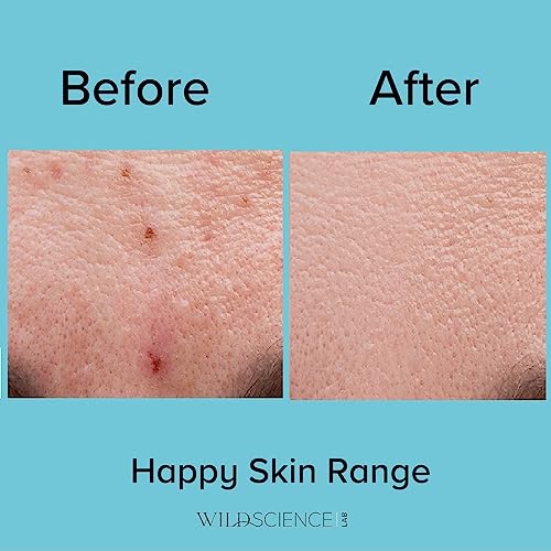 Wild Scicen Lab HAPPY BALANCE AHA + BHA + Zinc Clarifying Essence for Acne-Prone Skin