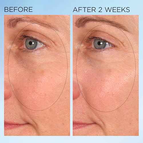 Elizabeth Arden Visible Brightening Clearly Radiant Spot Correcting Capsules, Skincare Gift for Women