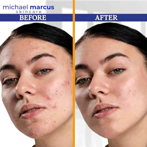 Michael Marcus Hydromarine¢â Vitamin C Face Serum PLUS with Hyaluronic Acid & Triple Peptides - Reduce Dark Spots, Anti-Wrinkle, Anti-Aging, & Skin Brightening Vitamin C Serum - (30ml, 1 fl. oz)