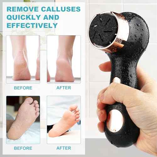 Electric Foot Callus Removers for Feet - Rechargeable Waterproof Portable Electronic Foot File Pedicure Tools for Cracked Heels Dead Skin
