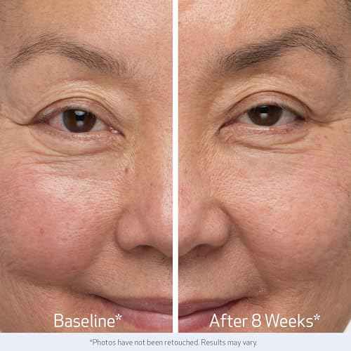 Obagi Nu-Cil Eyebrow Boosting Serum - Ultimate Eyebrow Growth Serum with Hyaluronic Acid - Dermatologist Approved for Thin, Patchy & Over-Tweezed Eyebrows - Fast Absorbing - 6ml