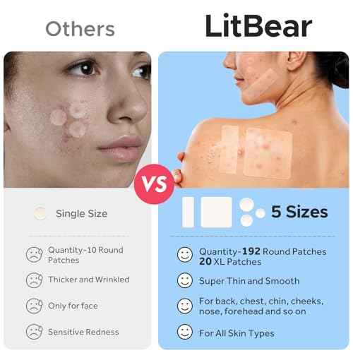 LitBear Large Pimple Patches, 5 Sizes 212 Counts Big Acne Patches for Face, Forehead, Body and Back, Hydrocolloid Bandages for Zits, Blemishes and Large Breakouts, Hydrocolloid Patch Pimple Stickers