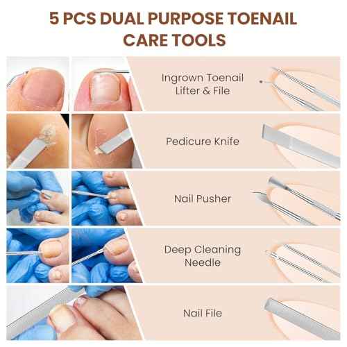 LIONVISON Ingrown Toenail Removal Kit: 8 Pcs Professional Toenail Clippers for Thick Toenails - Heavy Duty Nail Clippers Tools for Seniors Home Foot Care