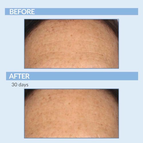 Retinol Vitamin A Resurfacing Pads for Daily Facial Treatment - Niacinamide & Witch Hazel - Exfoliates Skin & Pores - Reduces Fine Lines and Wrinkles - Serious Skincare - 60 Pre-Moistened Disc