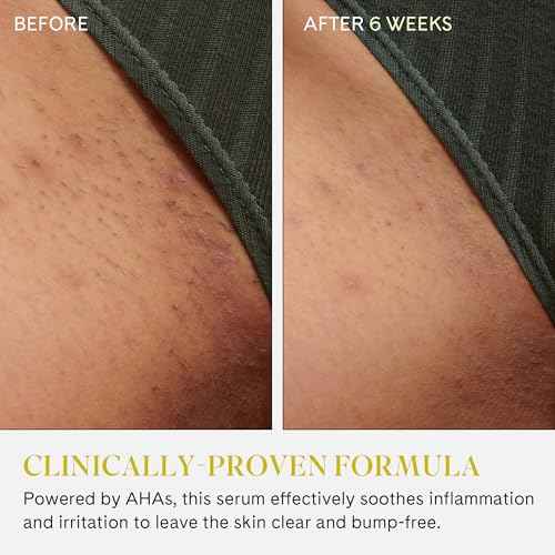 Fur Ingrown Eliminator Serum Rollerball - Powerful Ingrown Hair Treatment Serum With AHAs and BHAs to Treat and Prevent Ingrown Hairs and Bumps, Hydrates and Soothes Irritated Skin - 50 ml