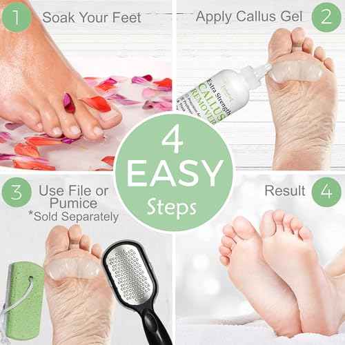 Dr. Entre's Callus Remover Gel: 8oz Extra Strength with Precision Applicator, Callus Remover for Feet, Foot Callus Remover, Foot Care, Pedicure Tools Supplies, Dead Skin Remover