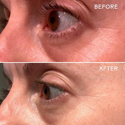 Three Ships - EyeHero Bio-Retinol Smoothing Eye Cream | Firm, Lift, Hydrate Under-Eye Area | Cruelty-Free, Vegan, Paraben-Free, Sensitive Skin Safe (0.5 oz | 15 g)