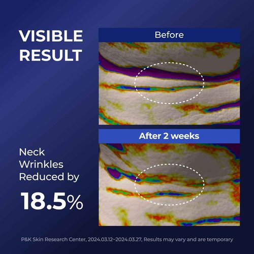 DOMINAS Atclinic Neck Firming Serum with Retinol & 5-Peptides – Reduce Wrinkles & Tech Neck Lines in 2 Weeks | Lightweight, Korean Skincare (1 fl oz)