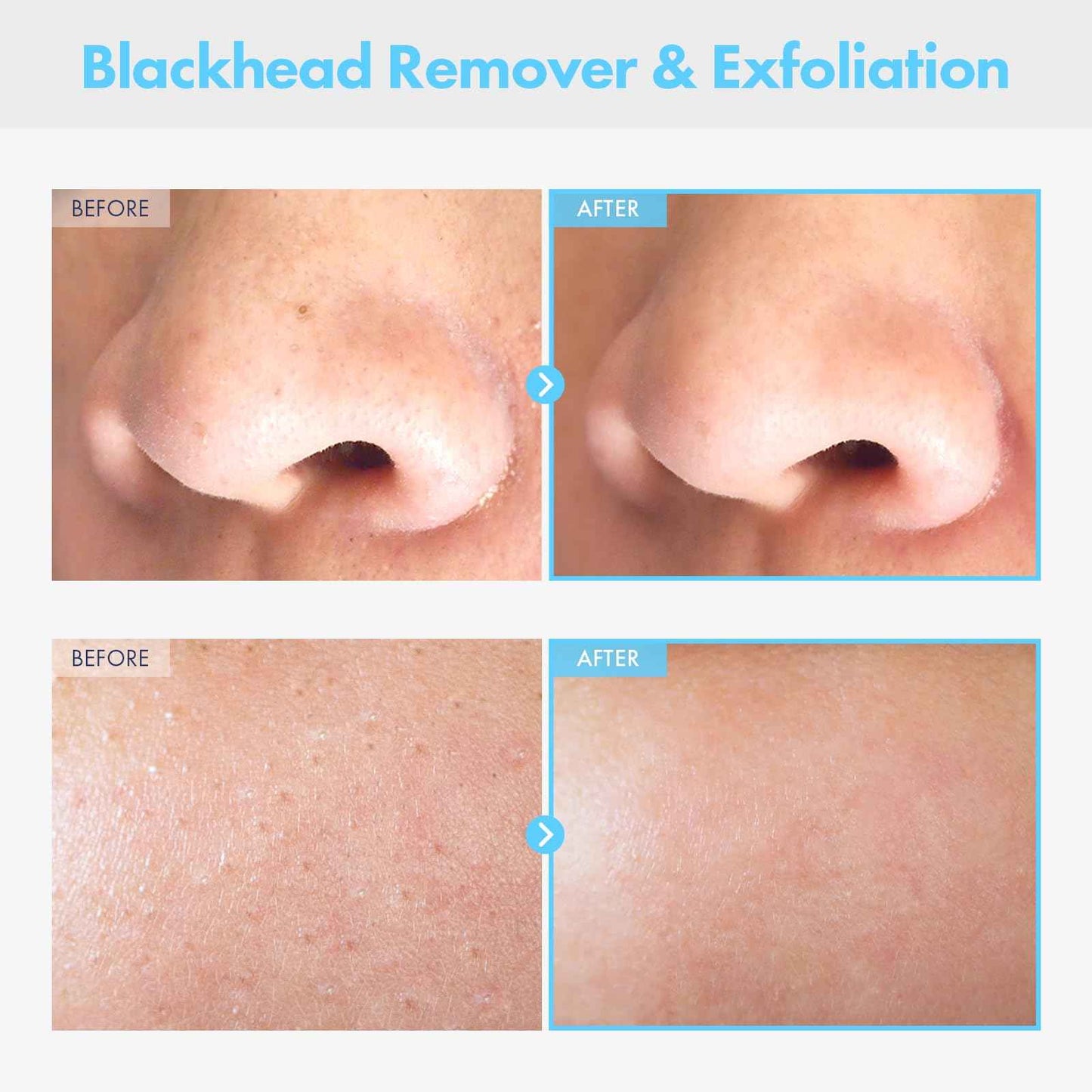 NATUREONE Pure Deep Cleansing Oil with AHA+PHA, Argan, Jojoba, Centella Asiatica, Blackhead Remover, Oil Based Cleanser for Face, Sebum Control, Pore Cleaner, Korean Skincare, 145ml, 4.9 fl. oz.