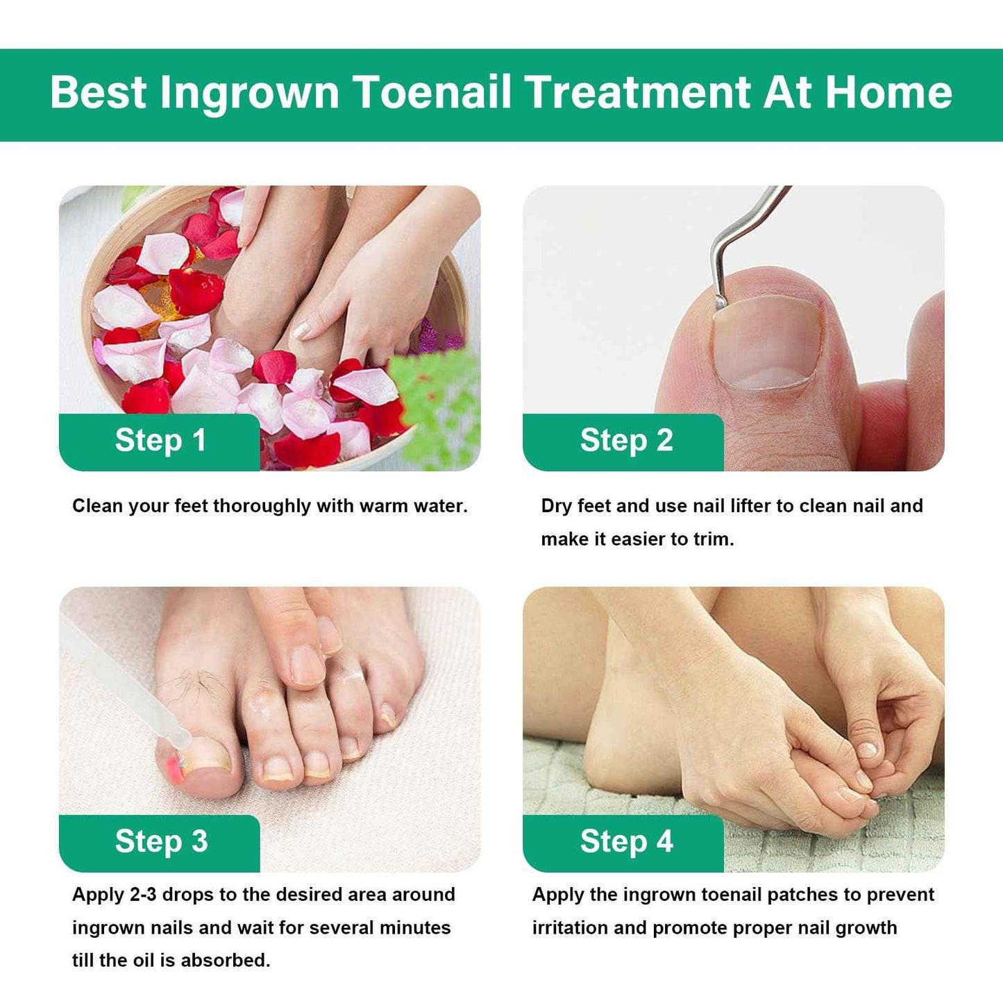Ingrown Toenail Treatment - Ingrown Toenail Softener Drops,Toenail Lifter,Nail Patches,Best Ingrown Toenail Treatment Kit at Home for Easy Trim Thick Toe Nails Cleaner Tool Kit (Green)