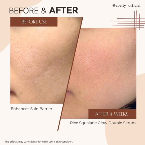 ABELTY Rice Squalane Glow Double Serum – Korean Hydrating Serum with Olive Squalane 5%, Rice Extract – Glass Skin, Anti-Pigmentation, Even Skin Tone, 50ml / 1.69 Fl.oz