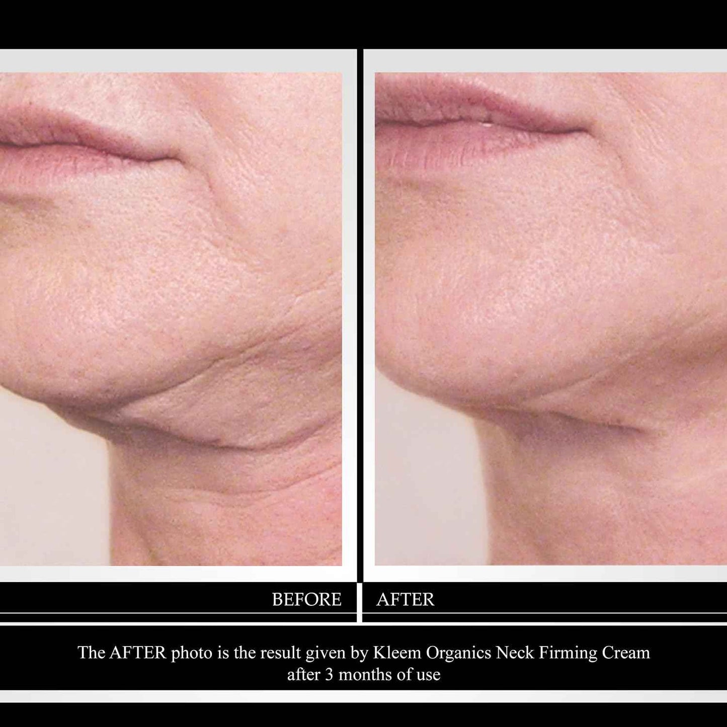 Kleem Neck Firming Cream | Retinol Moisturizer for Face & Décolleté | Anti Aging Cream for Women | Smooth Fine Lines, Wrinkles & Crepey Skin | Hydrating Collagen & Peptides | Made in USA | 1.7 oz