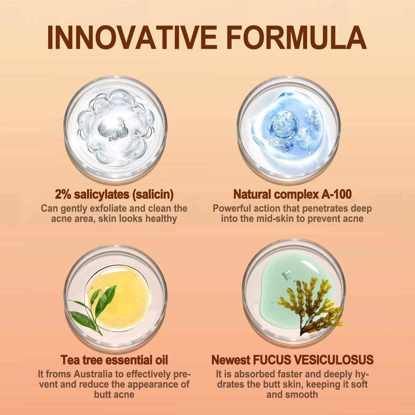 Butt Acne Clearing Treatment, Body Cream for Back, Buttocks, Thigh & Chest Acne, Skin Clearing Lotion for Men & Women 5.46 oz