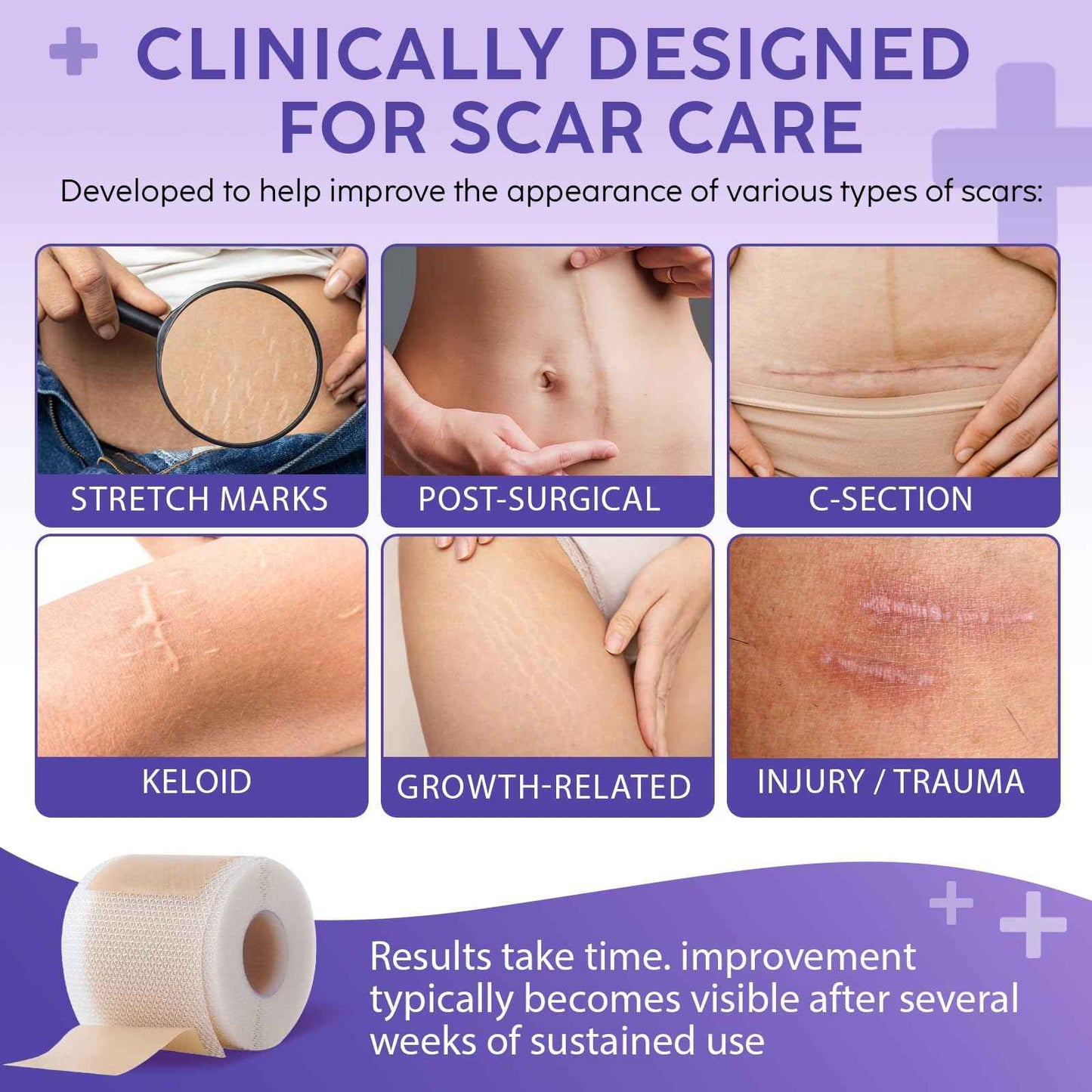 Silicone Scar Sheets, Silicone Scar Tape (1.6” x 60” Roll, 1.5M) – Reusable Silicone Scar Sheets for Surgical Scars, C-Section, Keloids, Burns, Acne, and Keloid Bump Removal