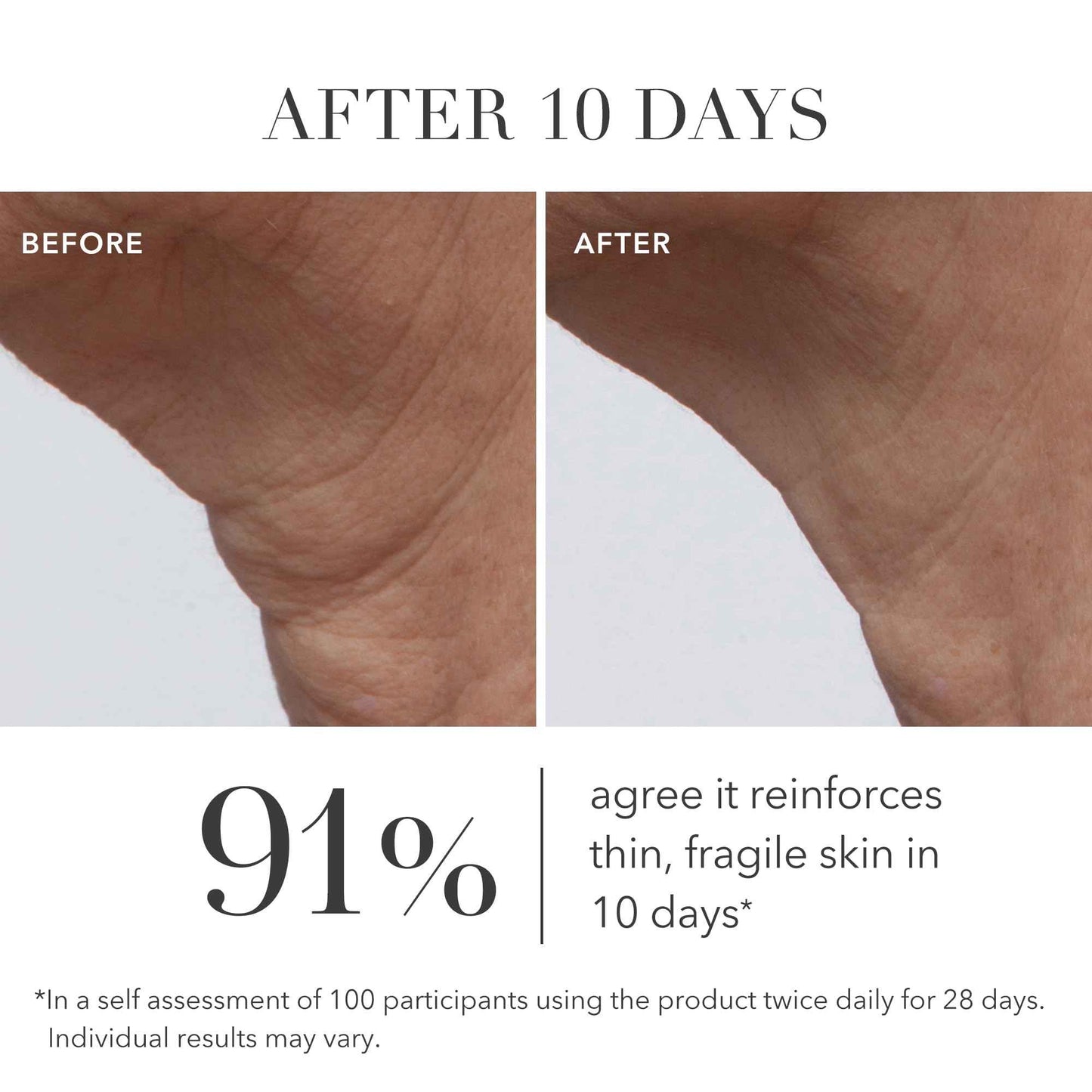 Algenist GENIUS Ultimate Anti-Aging Cream, Travel Size - Vegan Firming & Smoothing Moisturizer with Alguronic Acid & Microalgae Oil - Non-Comedogenic & Hypoallergenic Skincare (0.5 oz)