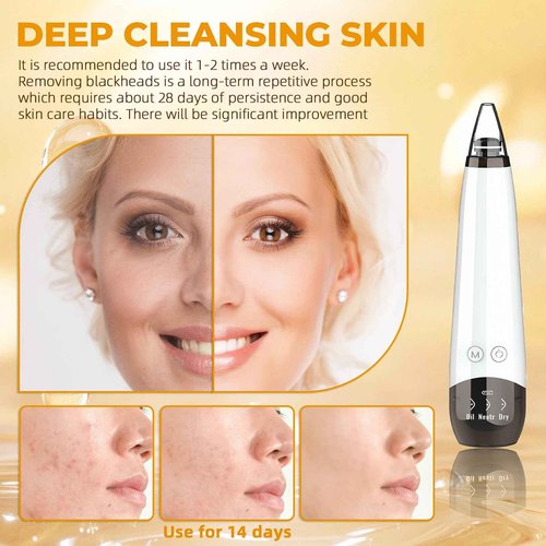 2025 Pore Vacuum, USB Rechargeable Blackhead Remover Vacuum,3 Levels Adjustable Pore Vacuum Blackhead Remover, with 6 Suction Power Probe,4 Golden Needle face Vacuum Pore Cleanser Kit-White