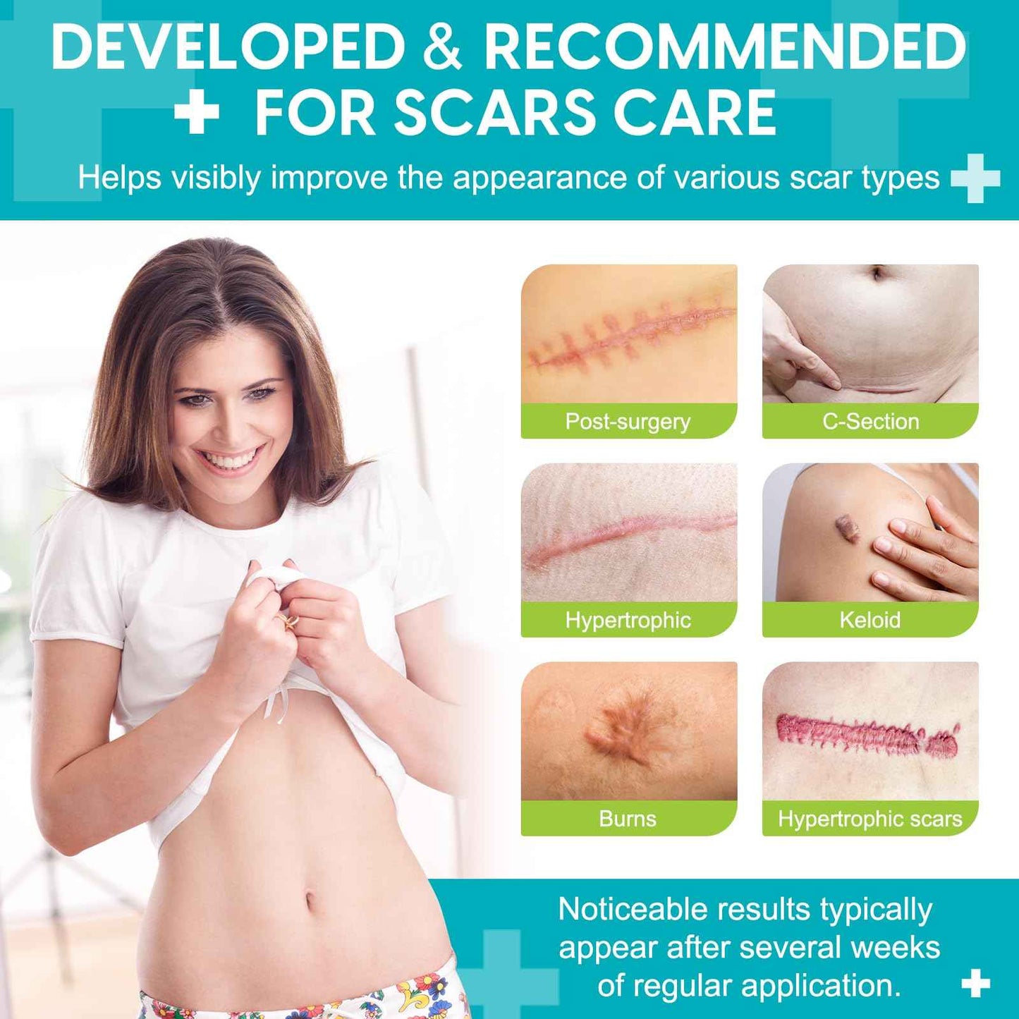 Silicone Scar Sheets (1.6” x 120”), Medical Grade Scar Tape for C-Section, Surgery, Keloid, Burn, Acne Scars - Reusable, Pain-Free, Safe for Sensitive Skin