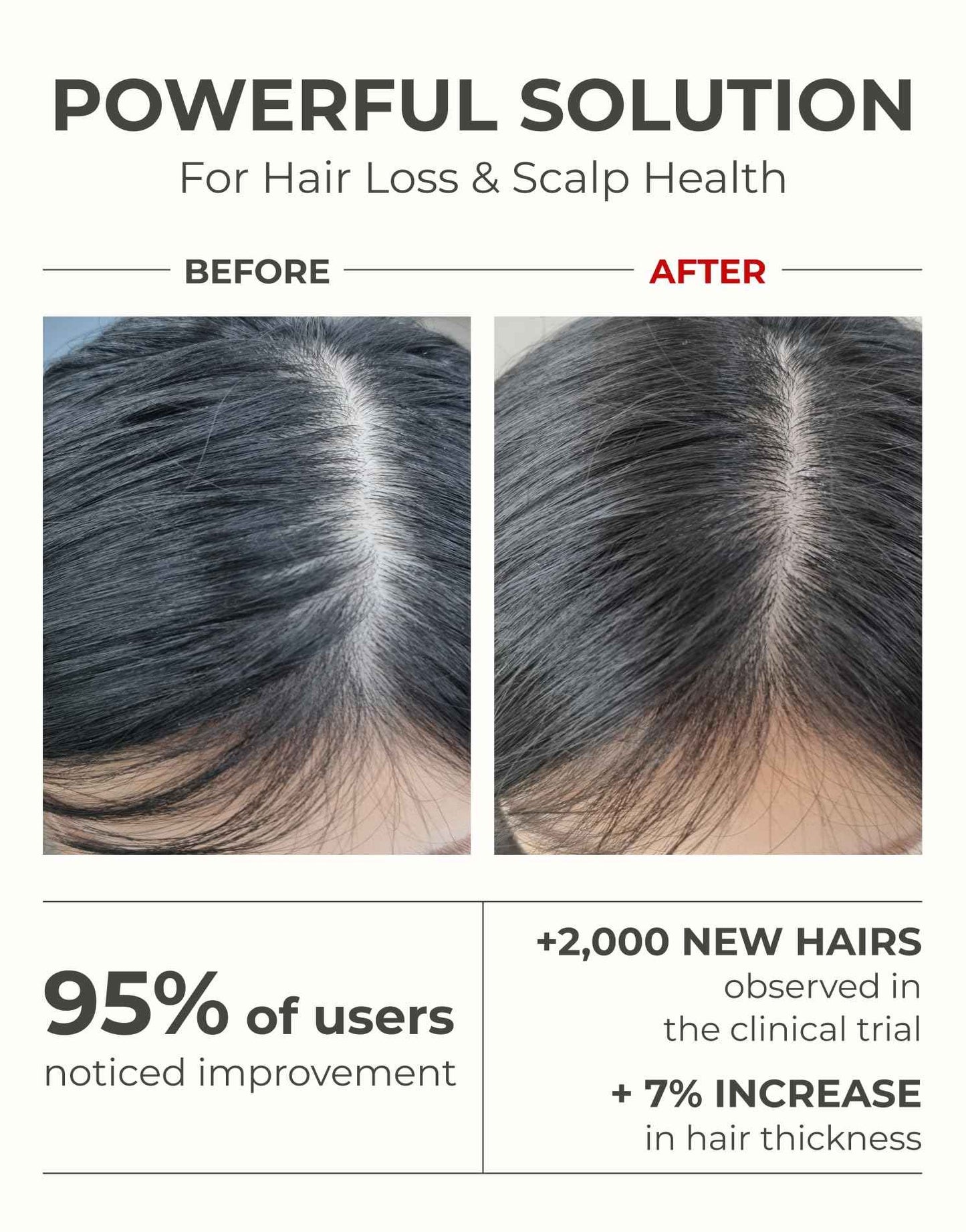 Motifull Hair Boosting Hair Thickening Shampoo for Thinning Hair with Biotin & Caffeine | Hair Growth Shampoo for Stronger Root & Volume (16.9 fl oz)