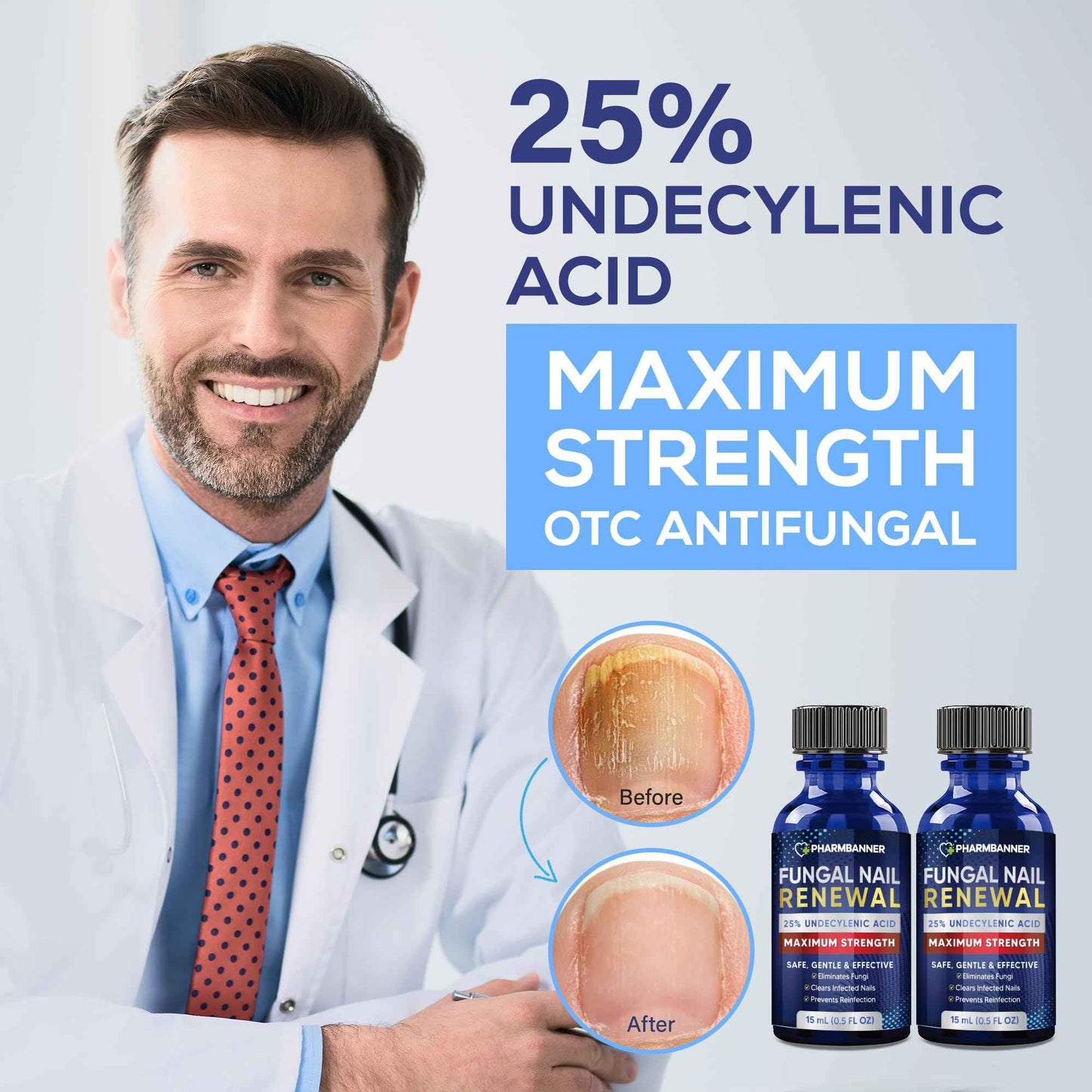 PHARMBANNER Toenail Fungus Treatment Extra Strength: 25% Undecylenic Acid Toe & Fingernail Fungus Renewal - Nail Fungus Treatment Kit with Brush & File - For Ingrown Nails & Discoloration