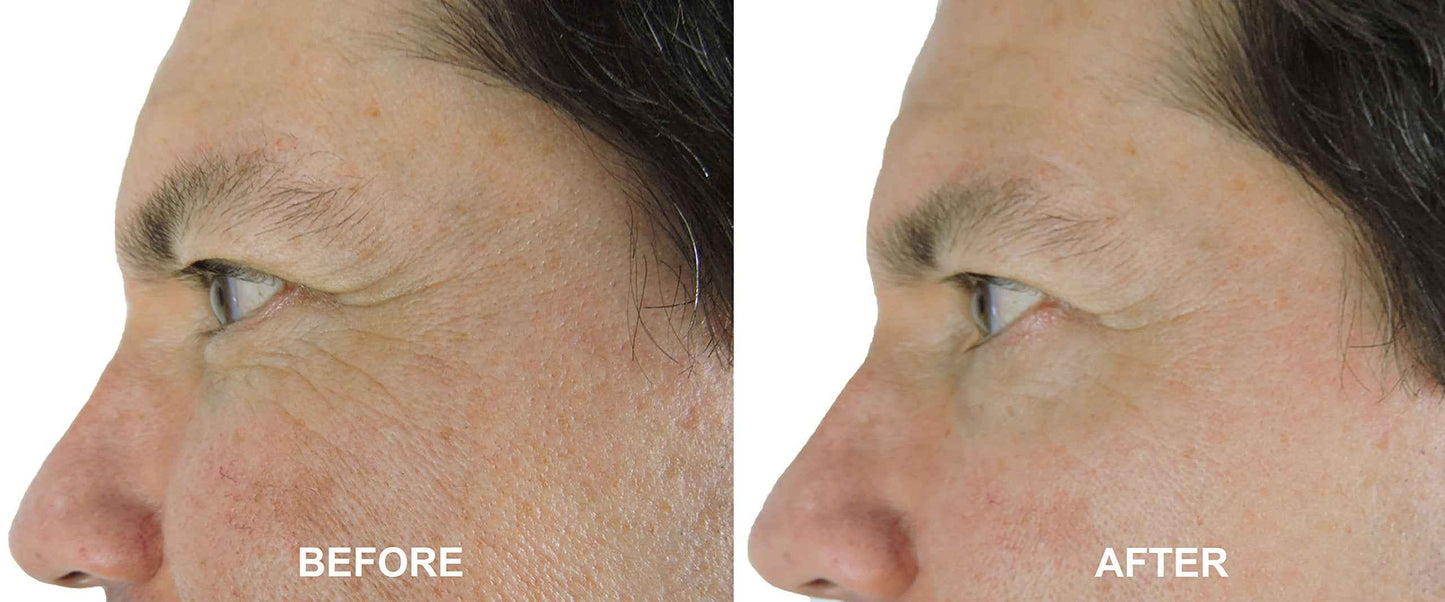 DNA Code®-No Needle Alternative-Argireline Copper Peptide Wrinkle Reduce Serum Booster w/Snap-8, Matrixyl 3000